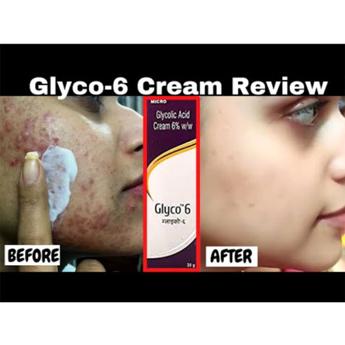 Glyco-6-Cream-30gm-3