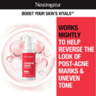 Neutrogena-Stubborn-Marks-PM-Treatment-29ml-6