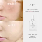 DR. ALTHEA NATURAL RADIANCE ESSENCE 30ML